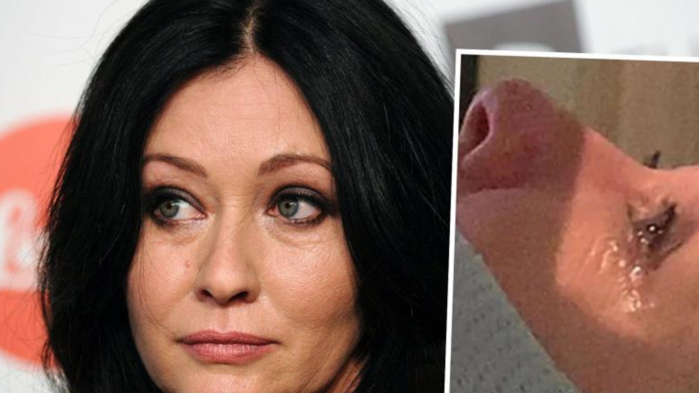 In tears, Shannen Doherty, suffering from breast cancer, shares images of her radiotherapy sessions, Magnate Daily